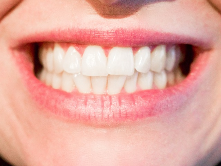 Zahnzusatzversicherung von AXA - Teure Zuzahlungen beim Zahnarzt vermeiden